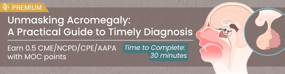 Unmasking Acromegaly: A Practical Guide to Timely Diagnosis