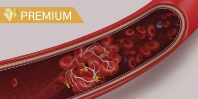 Management of Venous Thromboembolism in Ambulatory Patients With Cancer