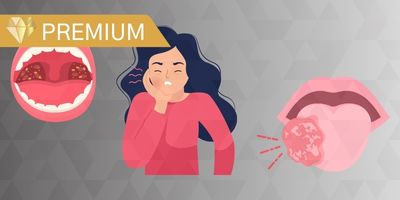 Nursing Management of Oral Mucositis